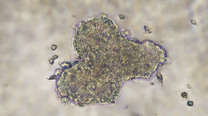 Ovarian cancer cells grown as spheroids.