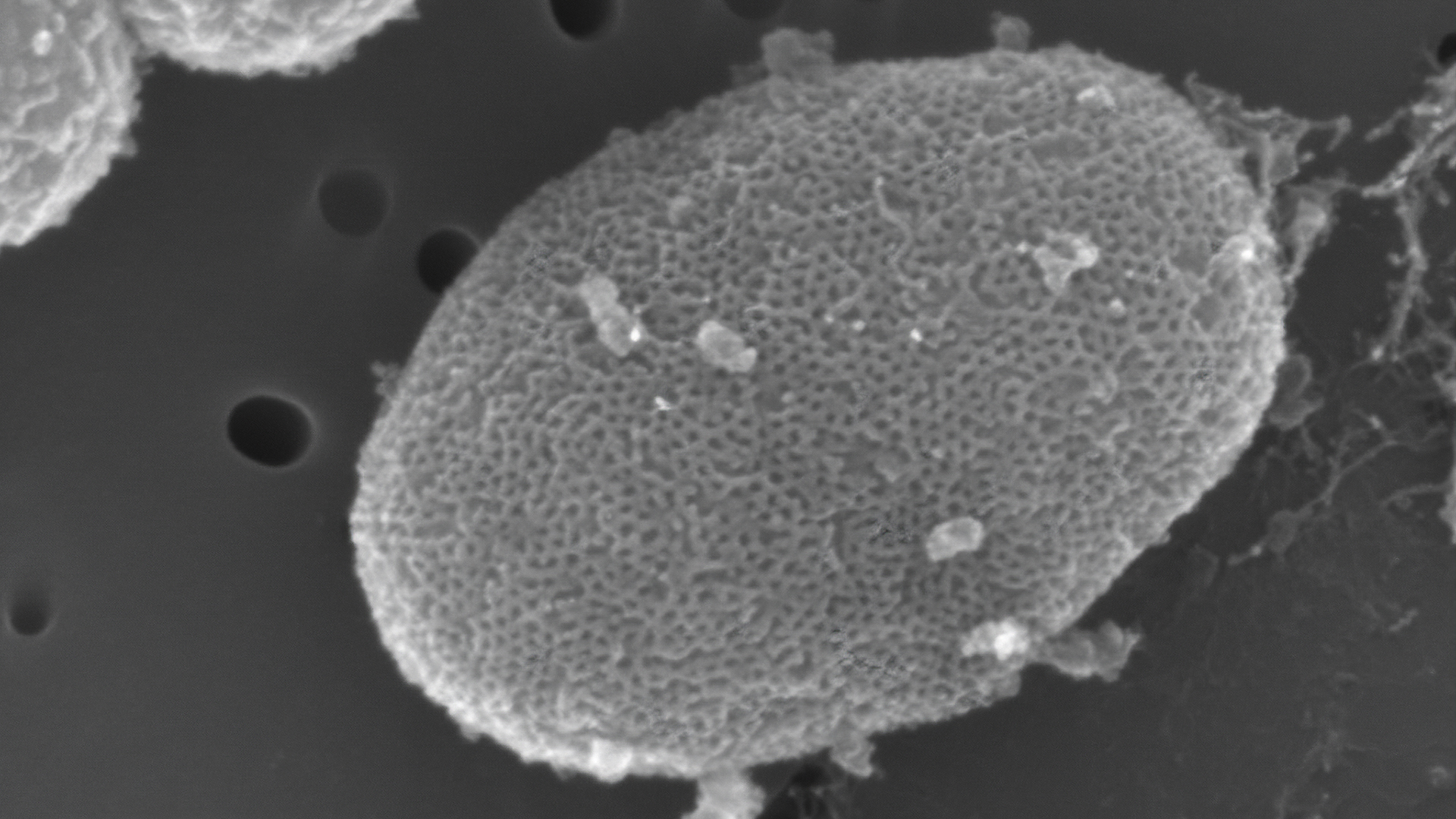 Crossroads of Cell Biology, Metals, and C1 Carbon Metabolism