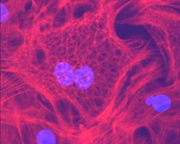 Cardiac Fibroblast