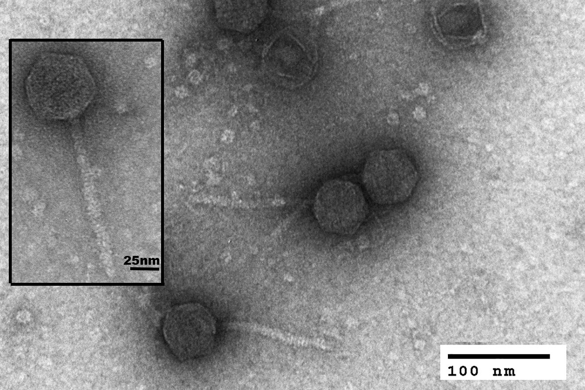 Bacteriophages under electron microscope