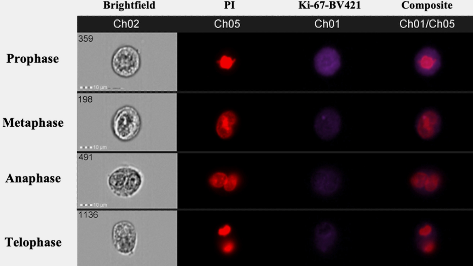 Understanding the Role of the Alternative NF-kB and MAPK Pathways in Maintaining Quiescence in Ovarian Cancer Stem-like Cells