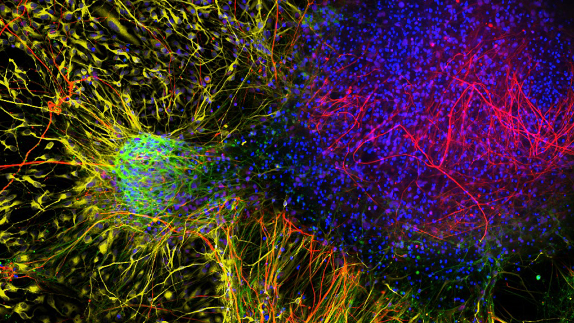 Monitoring Changes in Neural Plasticity Induced by 5-Methoxy-N,N-Dimethyltryptamine in Cortical Organoids