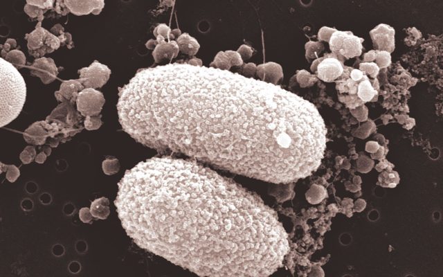 Bacterium Methylotuvimicrobium alcaliphilum 20ZR